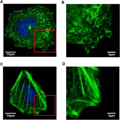 Effect of F-Actin Organization in Lamellipodium on Viscoelasticity and Migration of Huh-7 Cells Under pH Microenvironments Using AM-FM Atomic Force Microscopy